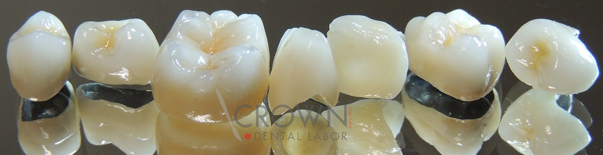 Crown Dental Labor