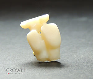 Crown Dental Labor