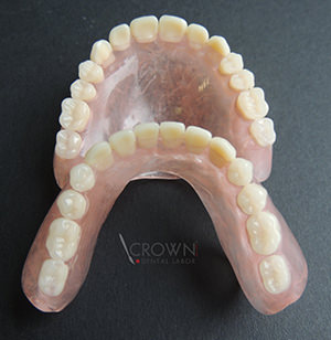 Crown Dental Labor