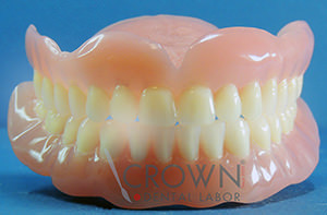 Crown Dental Labor