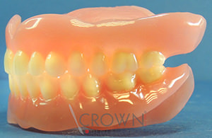 Crown Dental Labor