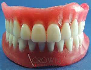 Crown Dental Labor