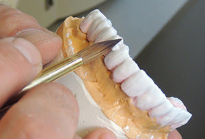 Crown Dental Labor