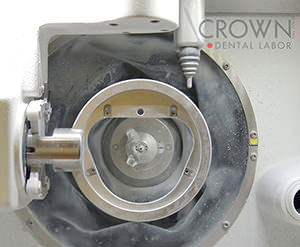 Crown Dental Labor