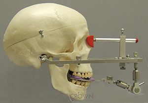 Crown Dental Labor