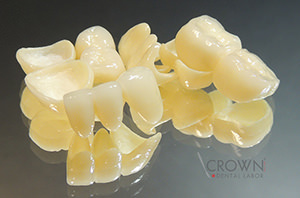 Crown Dental Labor