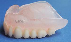 Crown Dental Labor