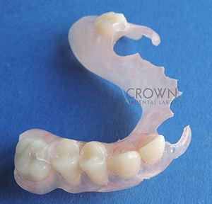 Crown Dental Labor