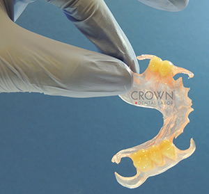 Crown Dental Labor