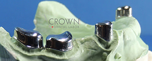 Crown Dental Labor