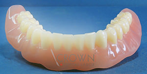 Crown Dental Labor