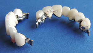 Crown Dental Labor