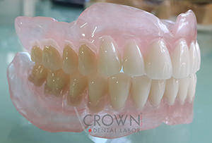 Crown Dental Labor