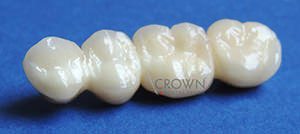 Crown Dental Labor