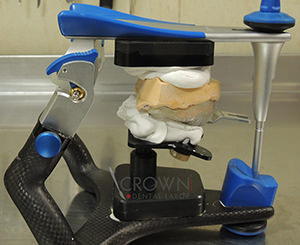 Crown Dental Labor