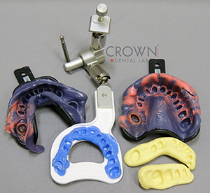 Crown Dental Labor