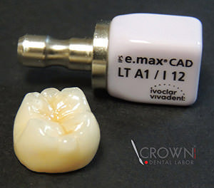 Crown Dental Labor