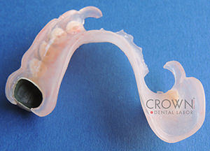 Crown Dental Labor