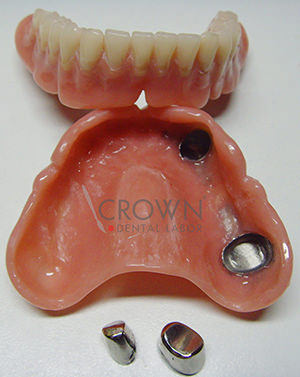 Crown Dental Labor