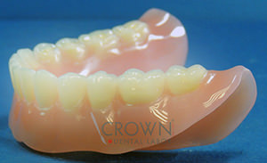 Crown Dental Labor