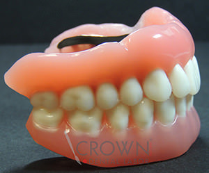Crown Dental Labor