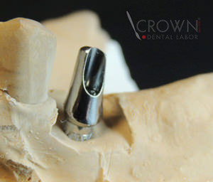 Crown Dental Labor