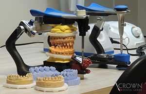 Crown Dental Labor