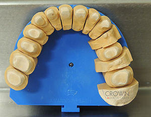 Crown Dental Labor